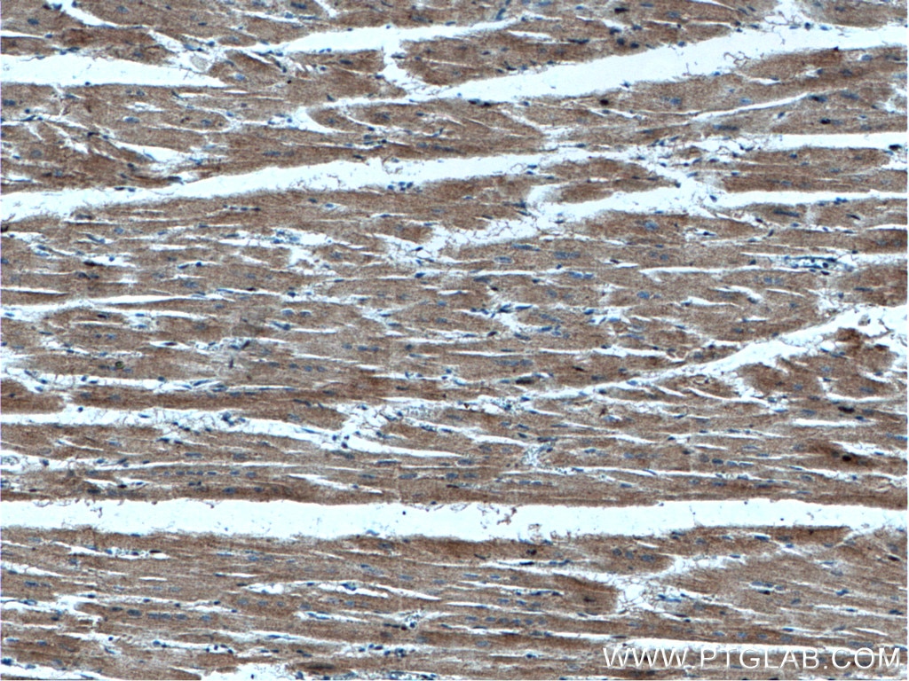 Immunohistochemistry (IHC) staining of human heart tissue using VPS39 Polyclonal antibody (16219-1-AP)