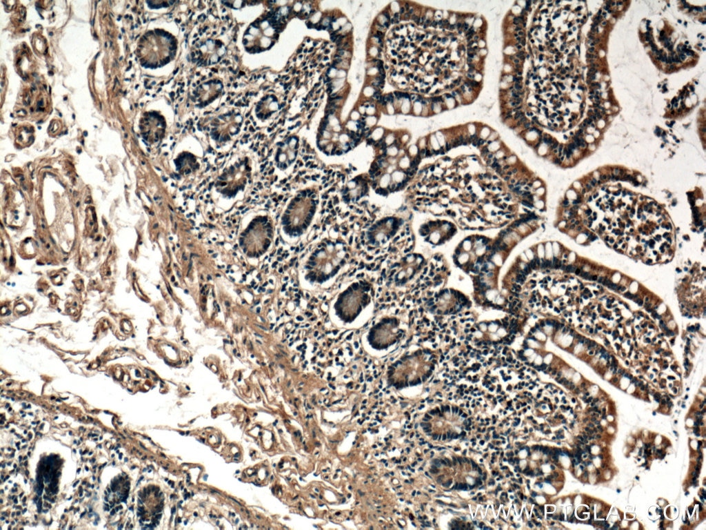 Immunohistochemistry (IHC) staining of human small intestine tissue using VPS39 Polyclonal antibody (16219-1-AP)
