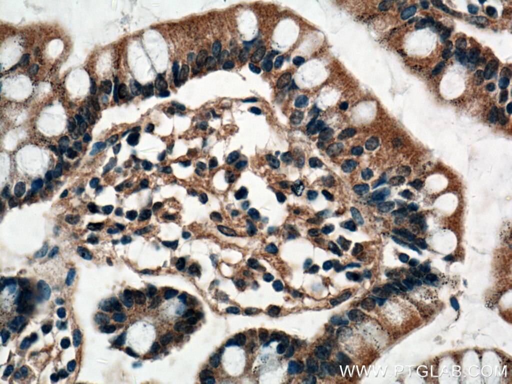 Immunohistochemistry (IHC) staining of human small intestine tissue using VPS39 Polyclonal antibody (16219-1-AP)