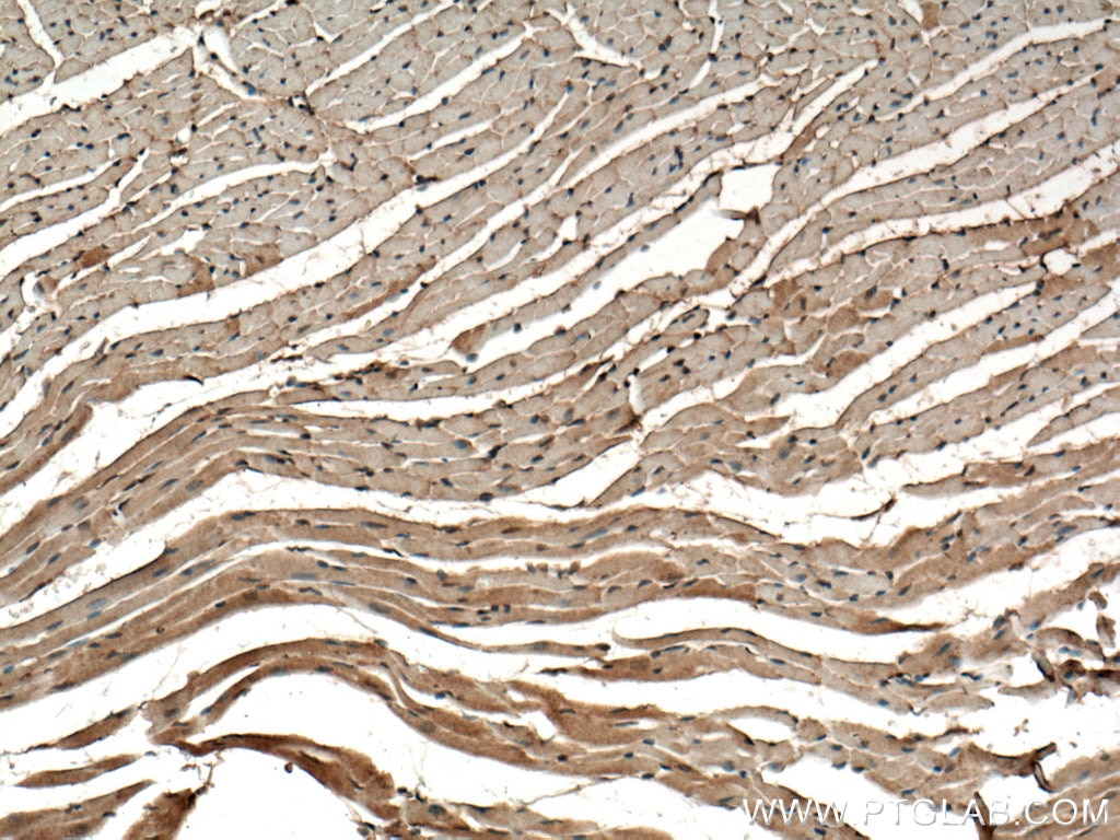 IHC staining of mouse heart using 16219-1-AP