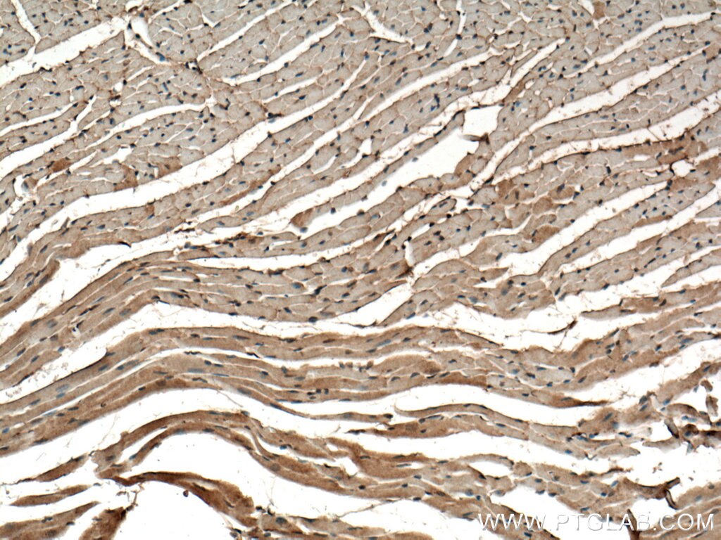 Immunohistochemistry (IHC) staining of mouse heart tissue using VPS39 Polyclonal antibody (16219-1-AP)