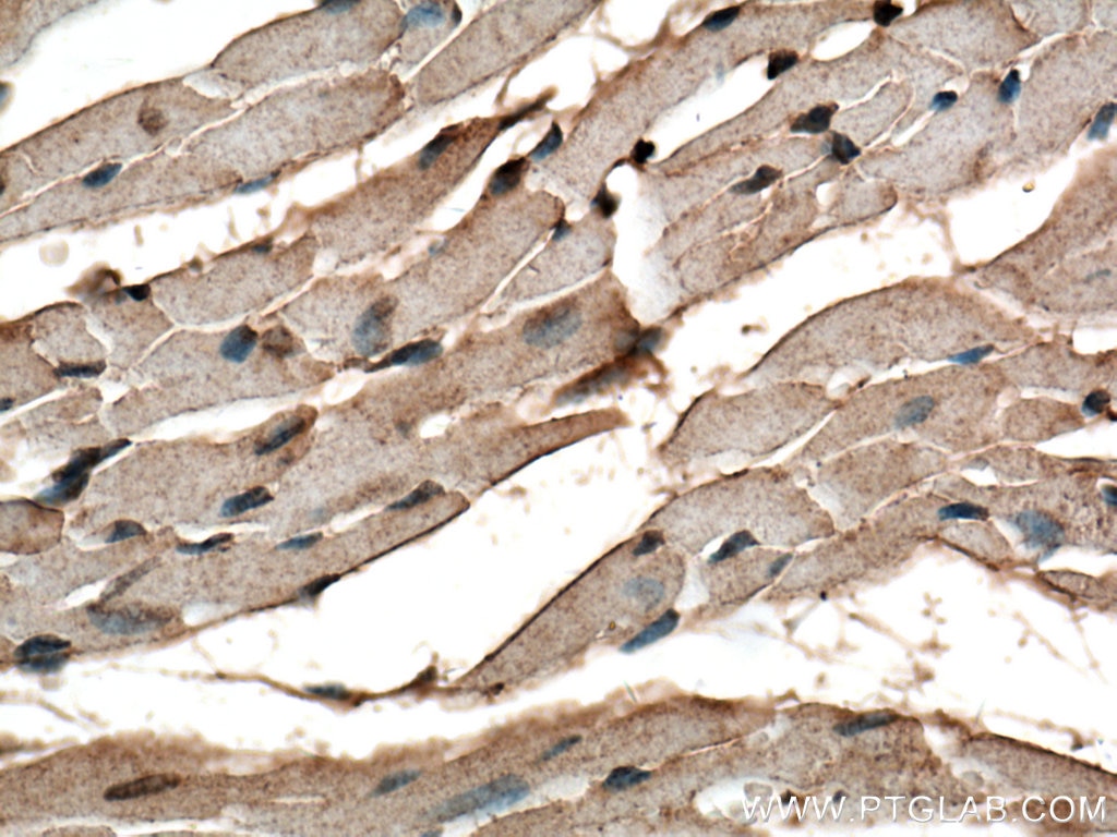 Immunohistochemistry (IHC) staining of mouse heart tissue using VPS39 Polyclonal antibody (16219-1-AP)