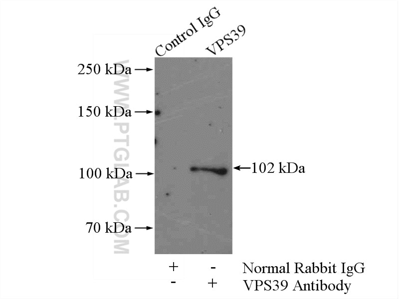 Immunoprecipitation (IP) experiment of mouse brain tissue using VPS39 Polyclonal antibody (16219-1-AP)