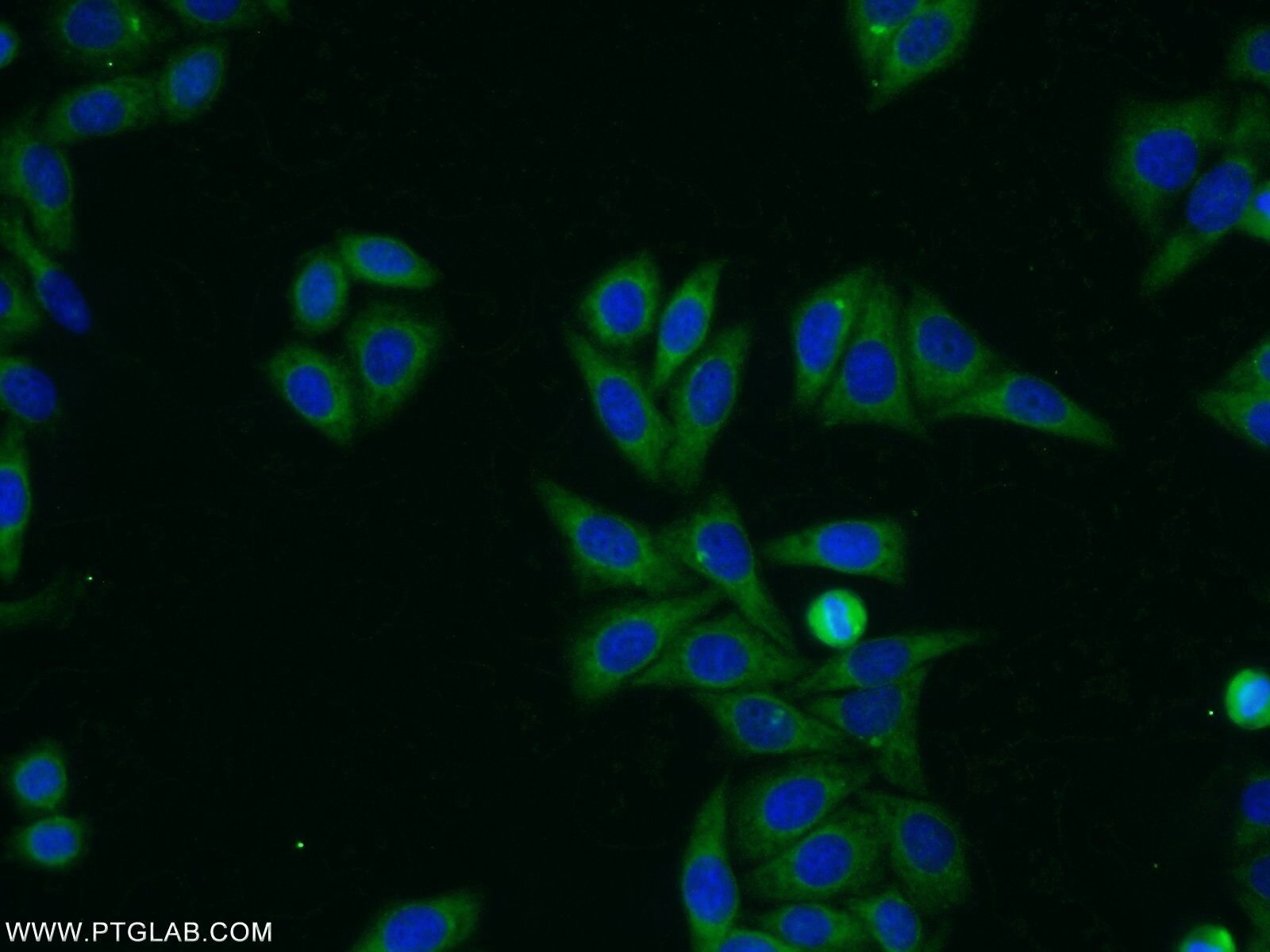 VPS41 Polyclonal antibody