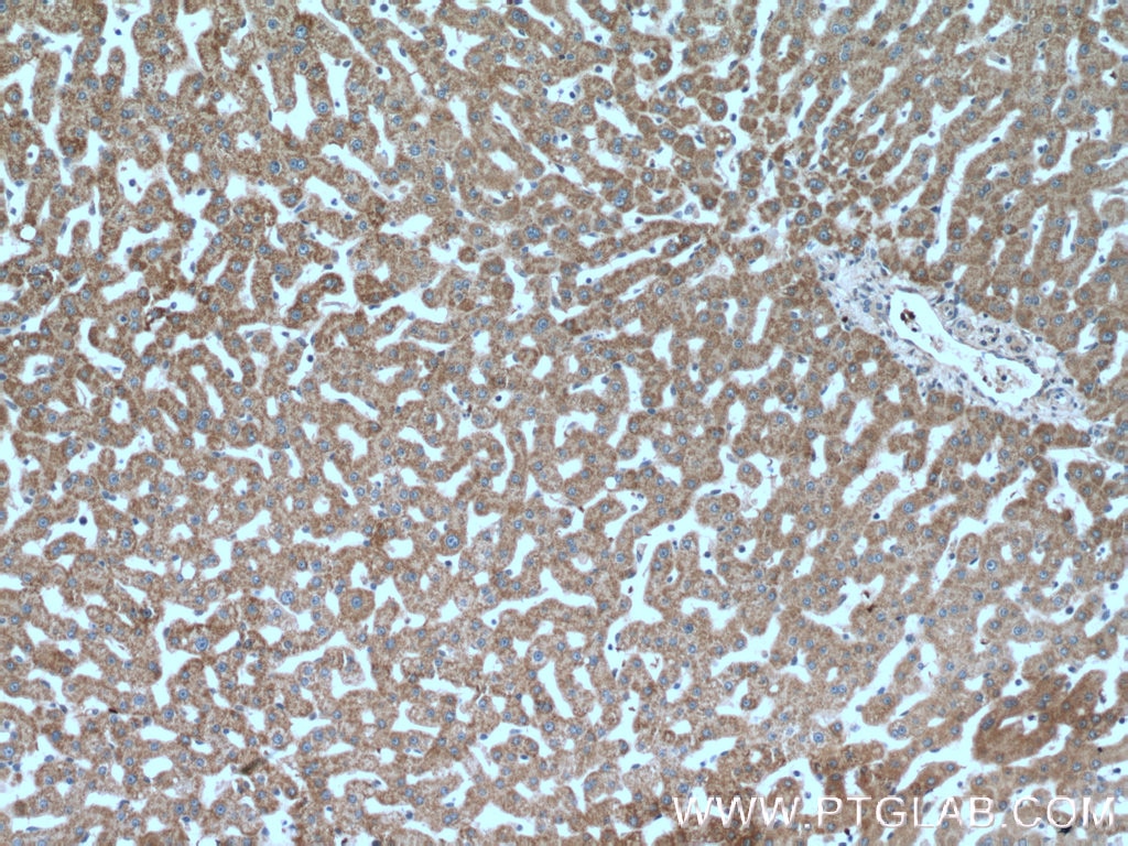 Immunohistochemistry (IHC) staining of human liver tissue using VPS41 Polyclonal antibody (13869-1-AP)