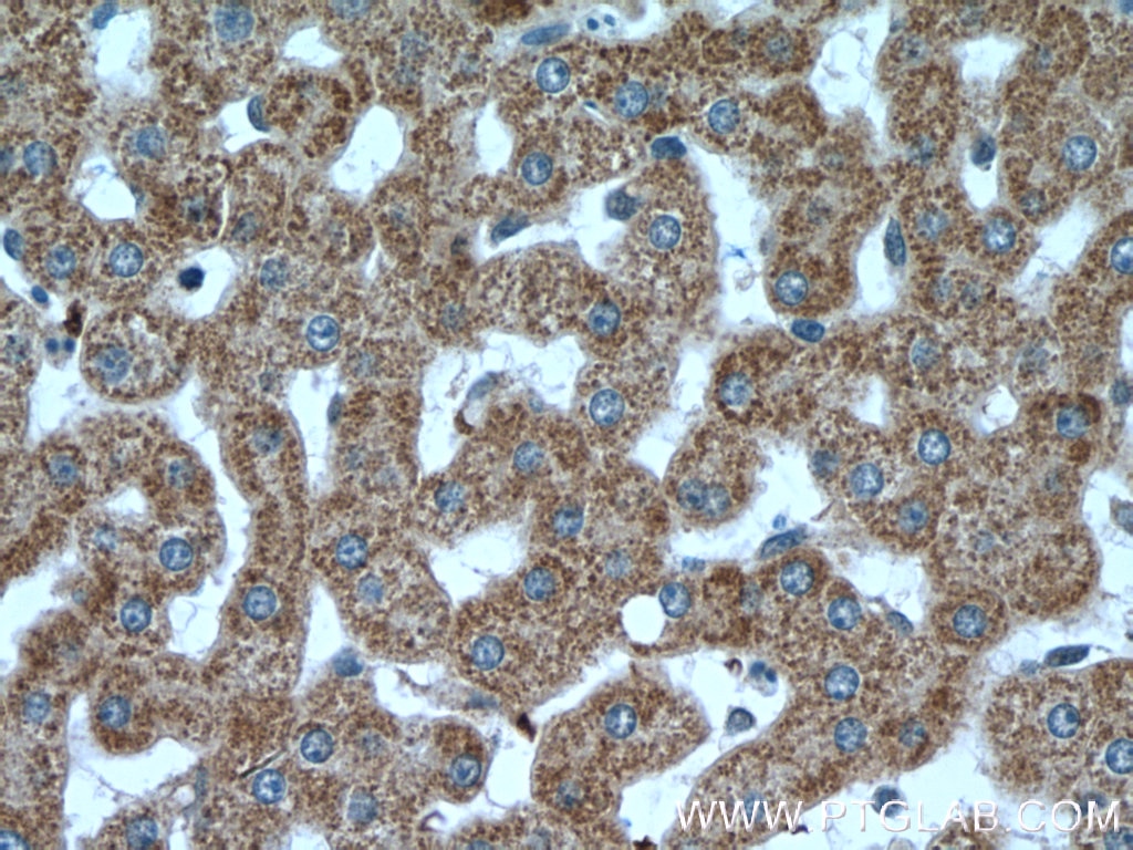 Immunohistochemistry (IHC) staining of human liver tissue using VPS41 Polyclonal antibody (13869-1-AP)