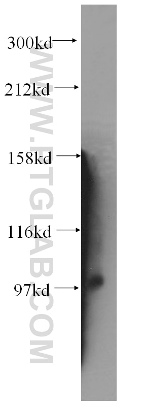 Western Blot (WB) analysis of human brain tissue using VPS41 Polyclonal antibody (13869-1-AP)