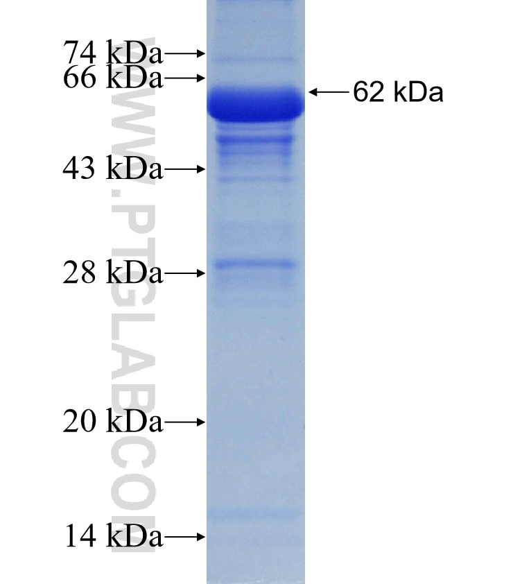 VPS41 fusion protein Ag4760 SDS-PAGE