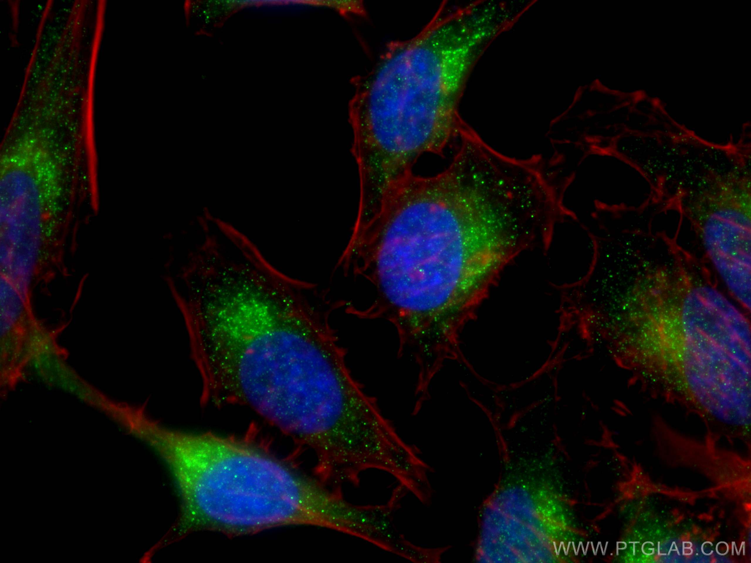 Immunofluorescence (IF) / fluorescent staining of HeLa cells using VPS45 Polyclonal antibody (12006-1-AP)