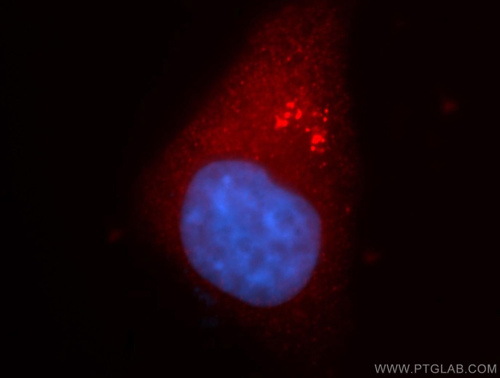 Immunofluorescence (IF) / fluorescent staining of HepG2 cells using VPS45 Polyclonal antibody (12006-1-AP)