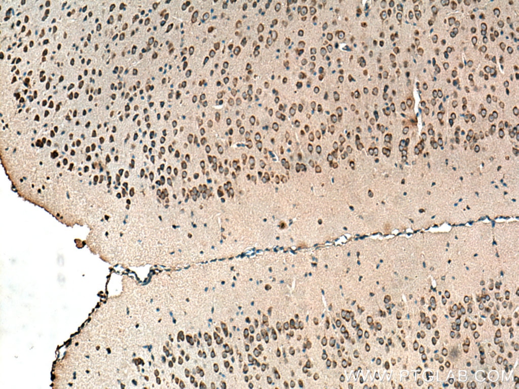 Immunohistochemistry (IHC) staining of mouse brain tissue using VPS45 Polyclonal antibody (12006-1-AP)