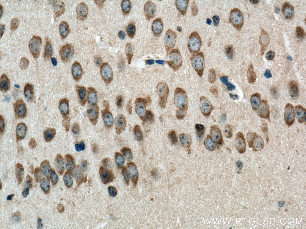 Immunohistochemistry (IHC) staining of mouse brain tissue using VPS45 Polyclonal antibody (12006-1-AP)