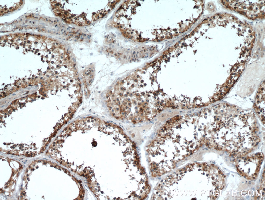 IHC staining of human testis using 12006-1-AP