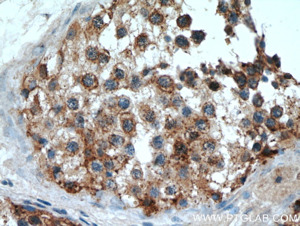 Immunohistochemistry (IHC) staining of human testis tissue using VPS45 Polyclonal antibody (12006-1-AP)