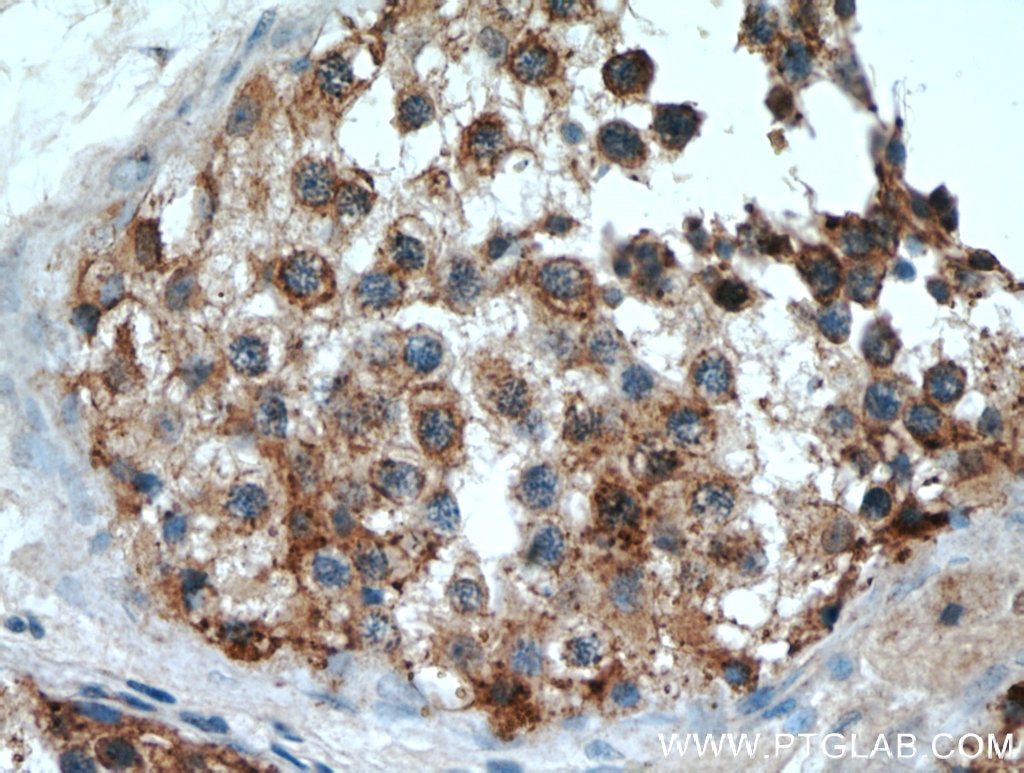 IHC staining of human testis using 12006-1-AP