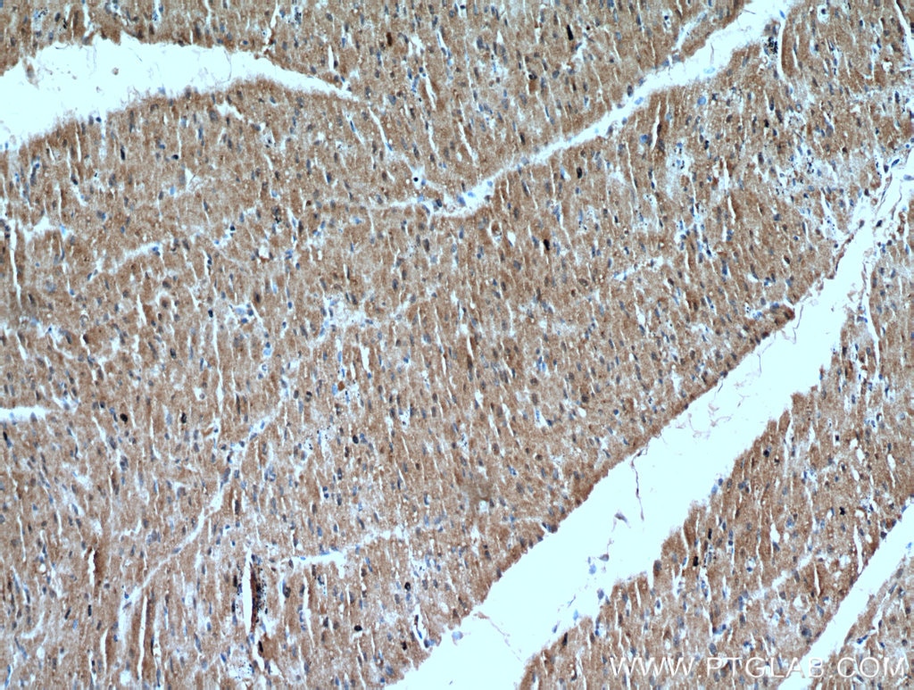 Immunohistochemistry (IHC) staining of human heart tissue using VPS45 Polyclonal antibody (12006-1-AP)