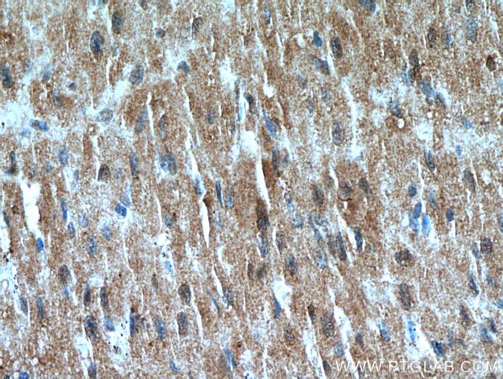 Immunohistochemistry (IHC) staining of human heart tissue using VPS45 Polyclonal antibody (12006-1-AP)