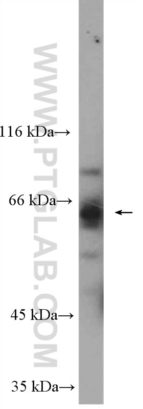 Western Blot (WB) analysis of RAW264.7 using VPS45 Polyclonal antibody (12006-1-AP)