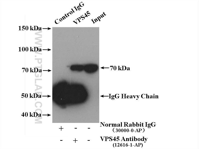 Immunoprecipitation (IP) experiment of mouse kidney tissue using VPS45 Polyclonal antibody (12616-1-AP)
