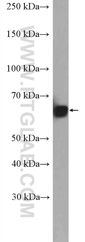 Western Blot (WB) analysis of mouse brain tissue using VPS45 Polyclonal antibody (12616-1-AP)