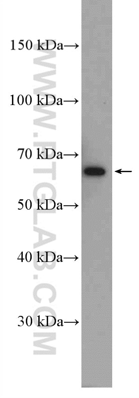 Western Blot (WB) analysis of rat pancreas tissue using VPS45 Polyclonal antibody (12616-1-AP)