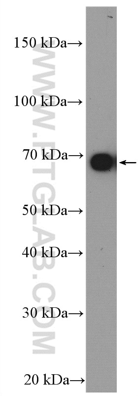 Western Blot (WB) analysis of mouse liver tissue using VPS45 Polyclonal antibody (12616-1-AP)