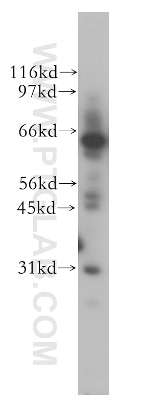 VPS45