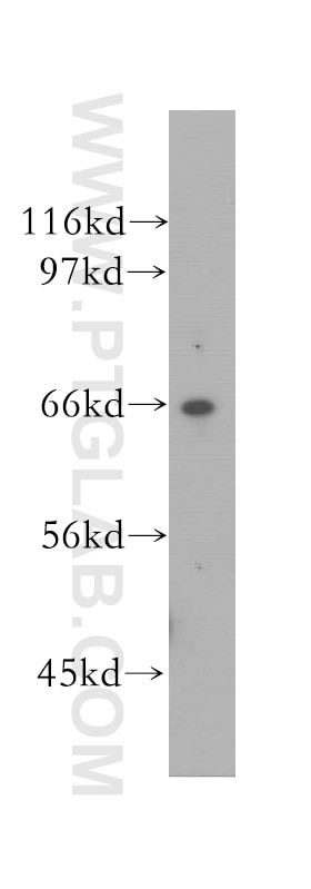 VPS45 Polyclonal antibody
