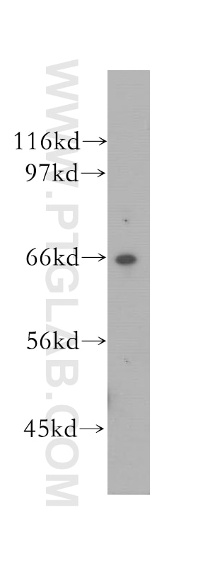 WB analysis of human kidney using 12616-1-AP