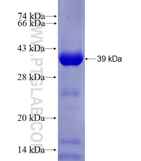 VPS45 fusion protein Ag27798 SDS-PAGE