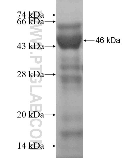 VPS45 fusion protein Ag19243 SDS-PAGE VPS45 fusion protein Ag19243 SDS-PAGE