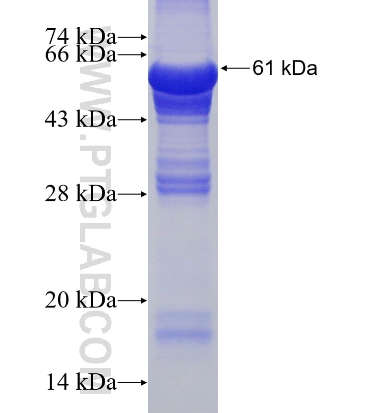 VPS45 fusion protein Ag2658 SDS-PAGE
