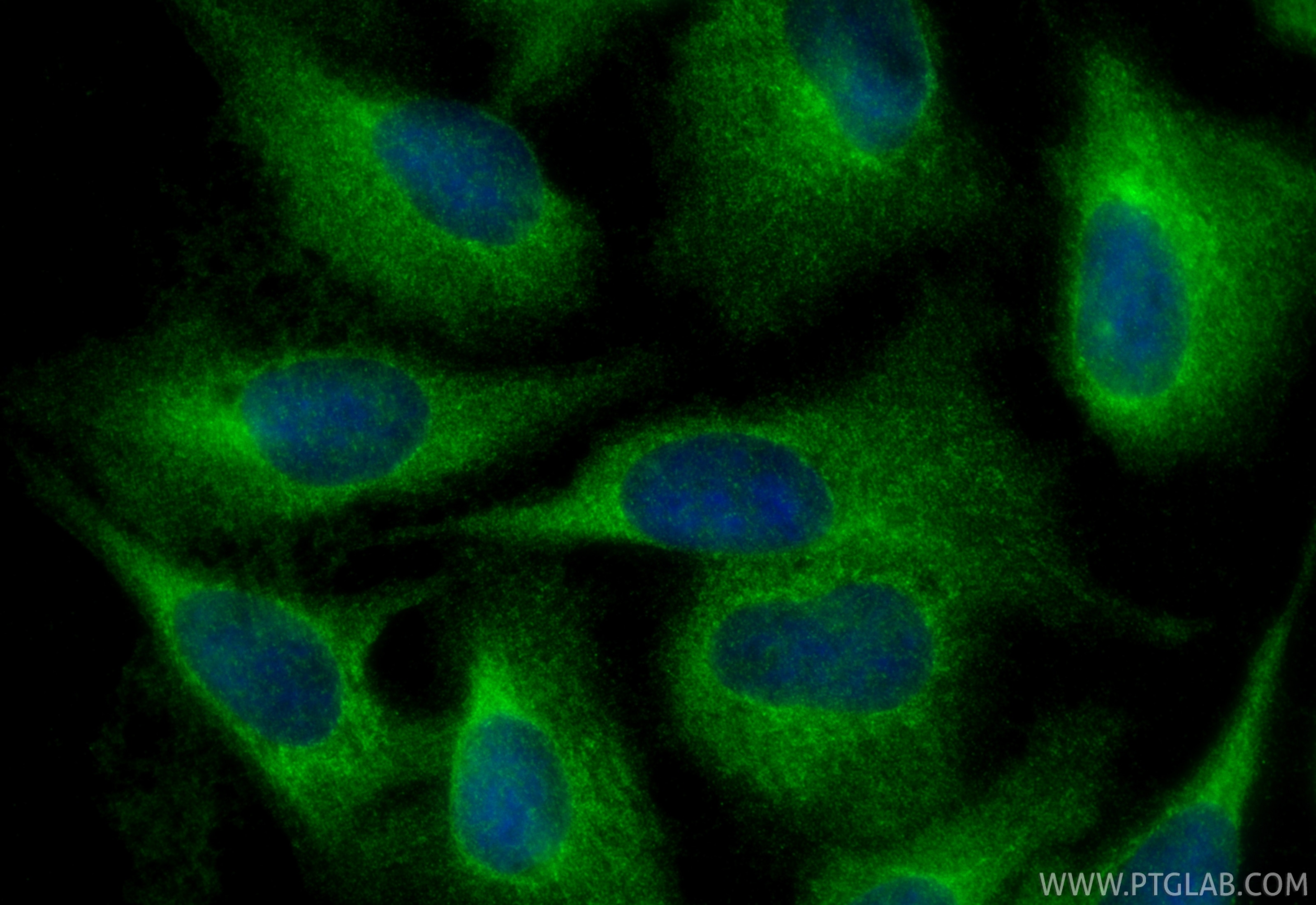 Immunofluorescence (IF) / fluorescent staining of U2OS cells using VPS4A Polyclonal antibody (14272-1-AP)