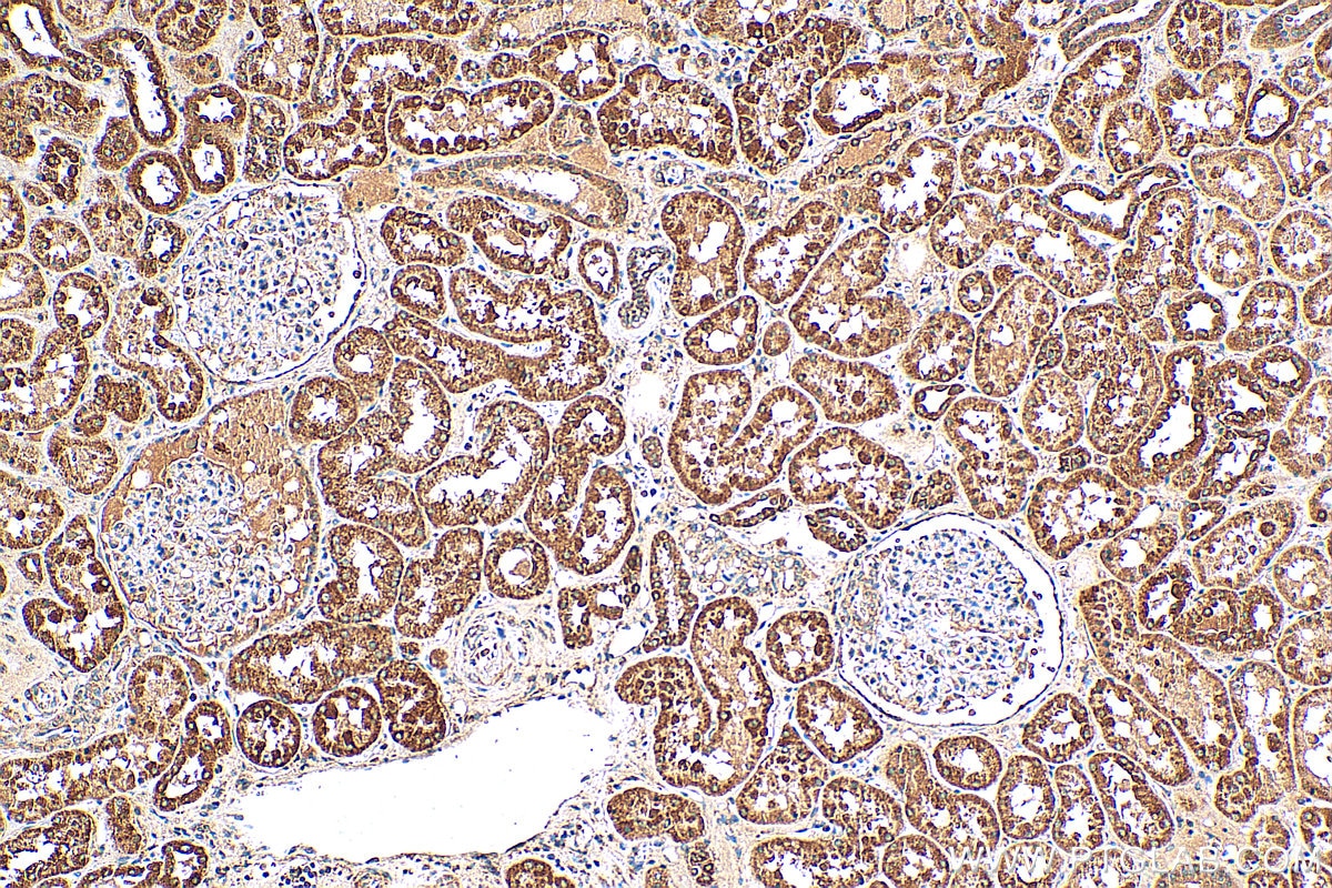 Immunohistochemistry (IHC) staining of human kidney tissue using VPS4A Polyclonal antibody (14272-1-AP)