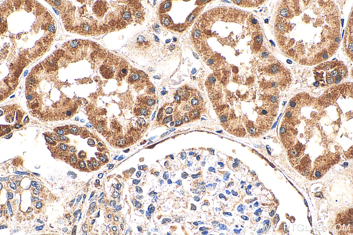 Immunohistochemistry (IHC) staining of human kidney tissue using VPS4A Polyclonal antibody (14272-1-AP)