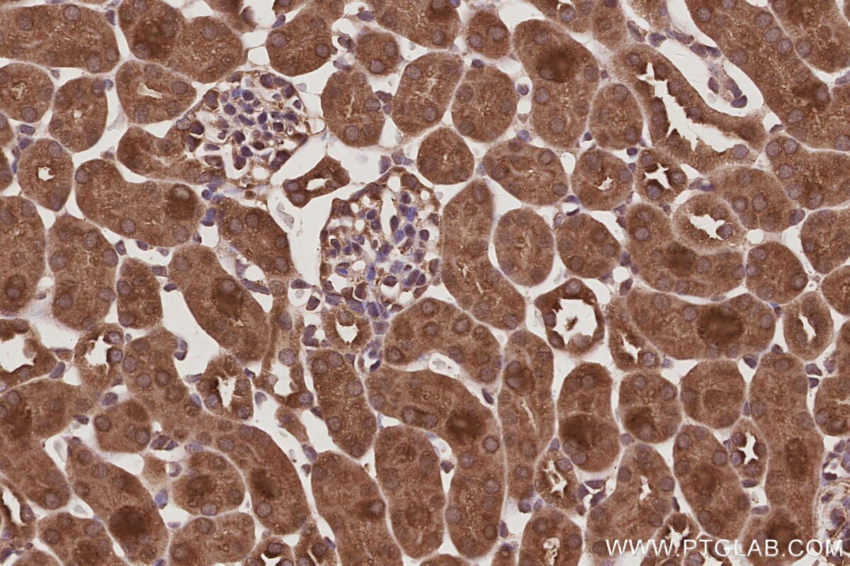 Immunohistochemistry (IHC) staining of mouse kidney tissue using VPS4A Polyclonal antibody (14272-1-AP)