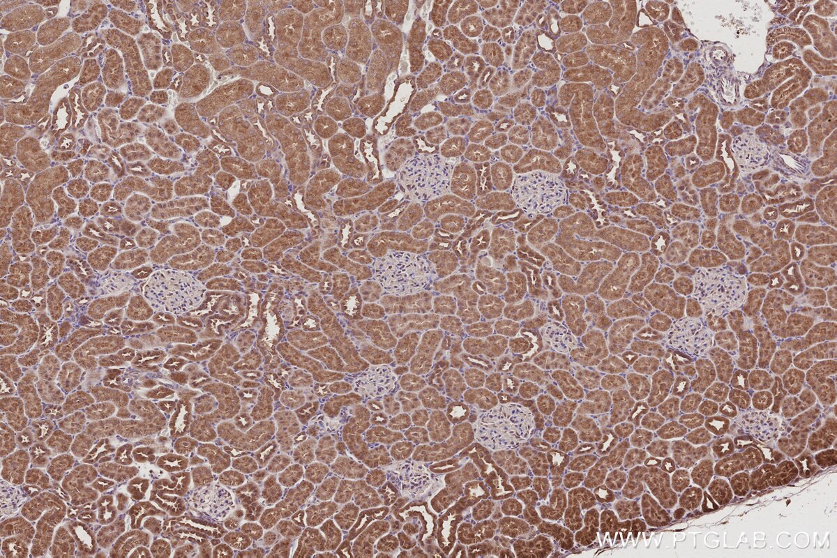 Immunohistochemistry (IHC) staining of rat kidney tissue using VPS4A Polyclonal antibody (14272-1-AP)