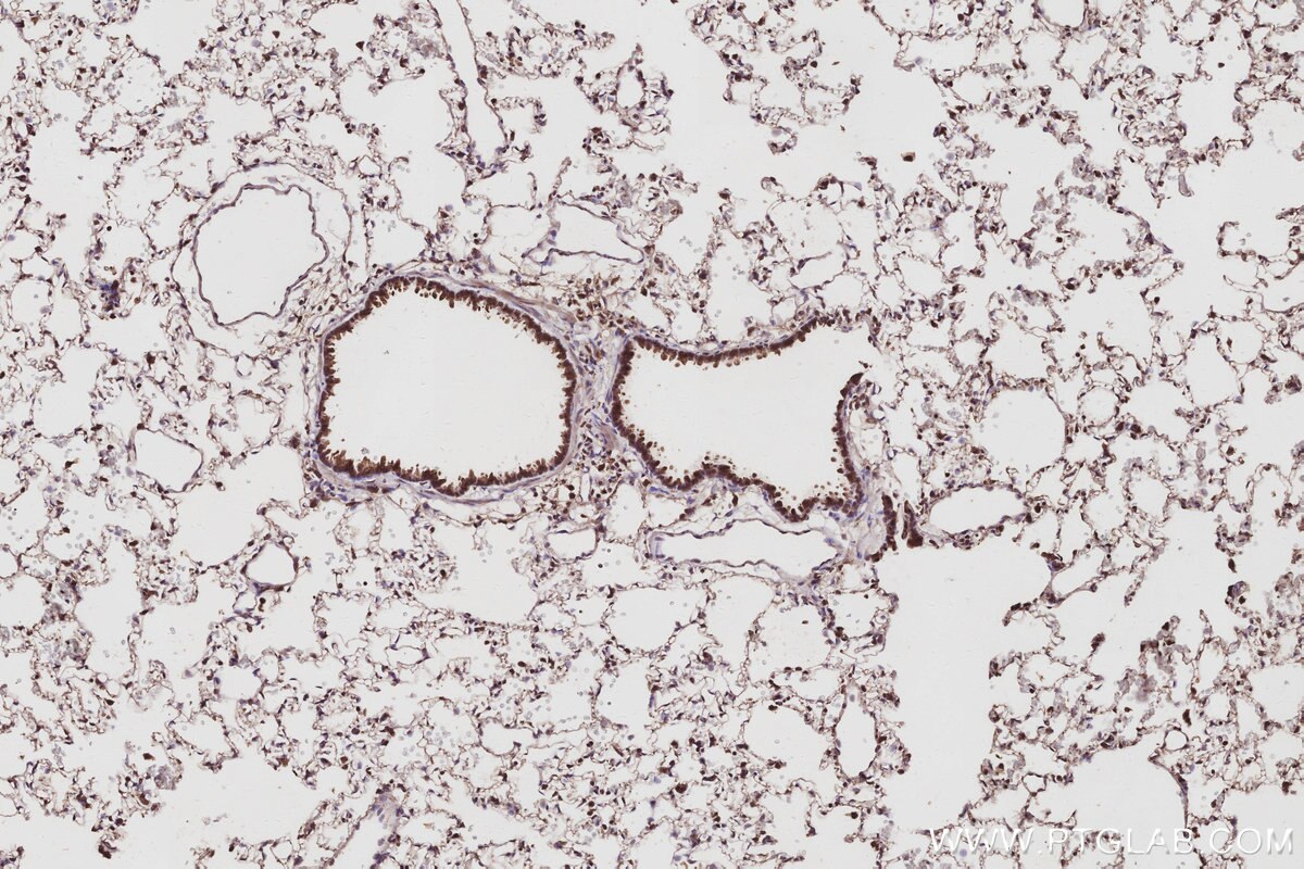 Immunohistochemistry (IHC) staining of rat lung tissue using VPS4A Polyclonal antibody (14272-1-AP)