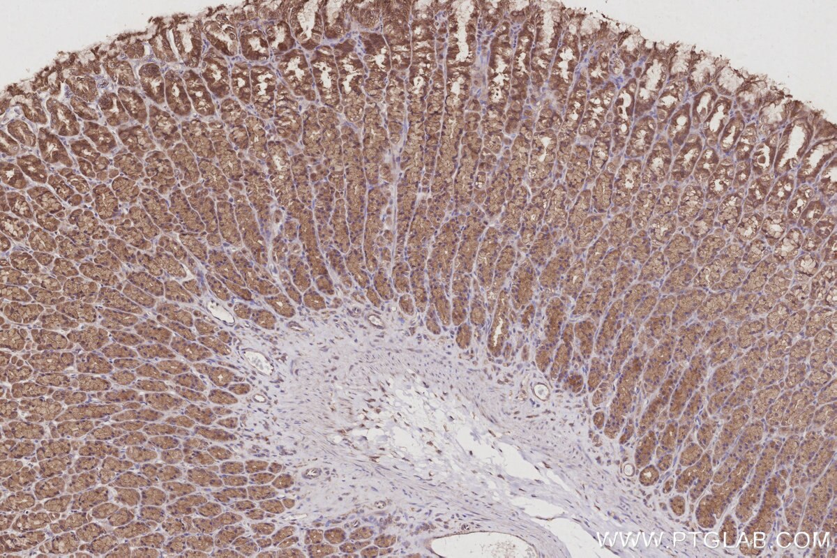 Immunohistochemistry (IHC) staining of rat stomach tissue using VPS4A Polyclonal antibody (14272-1-AP)
