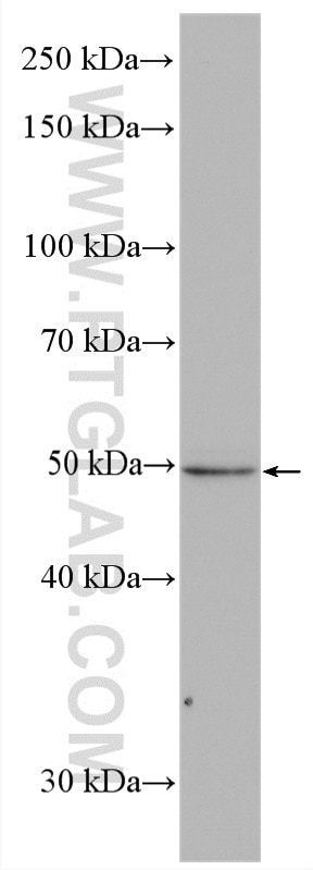 WB analysis of SMMC-7721 using 14272-1-AP