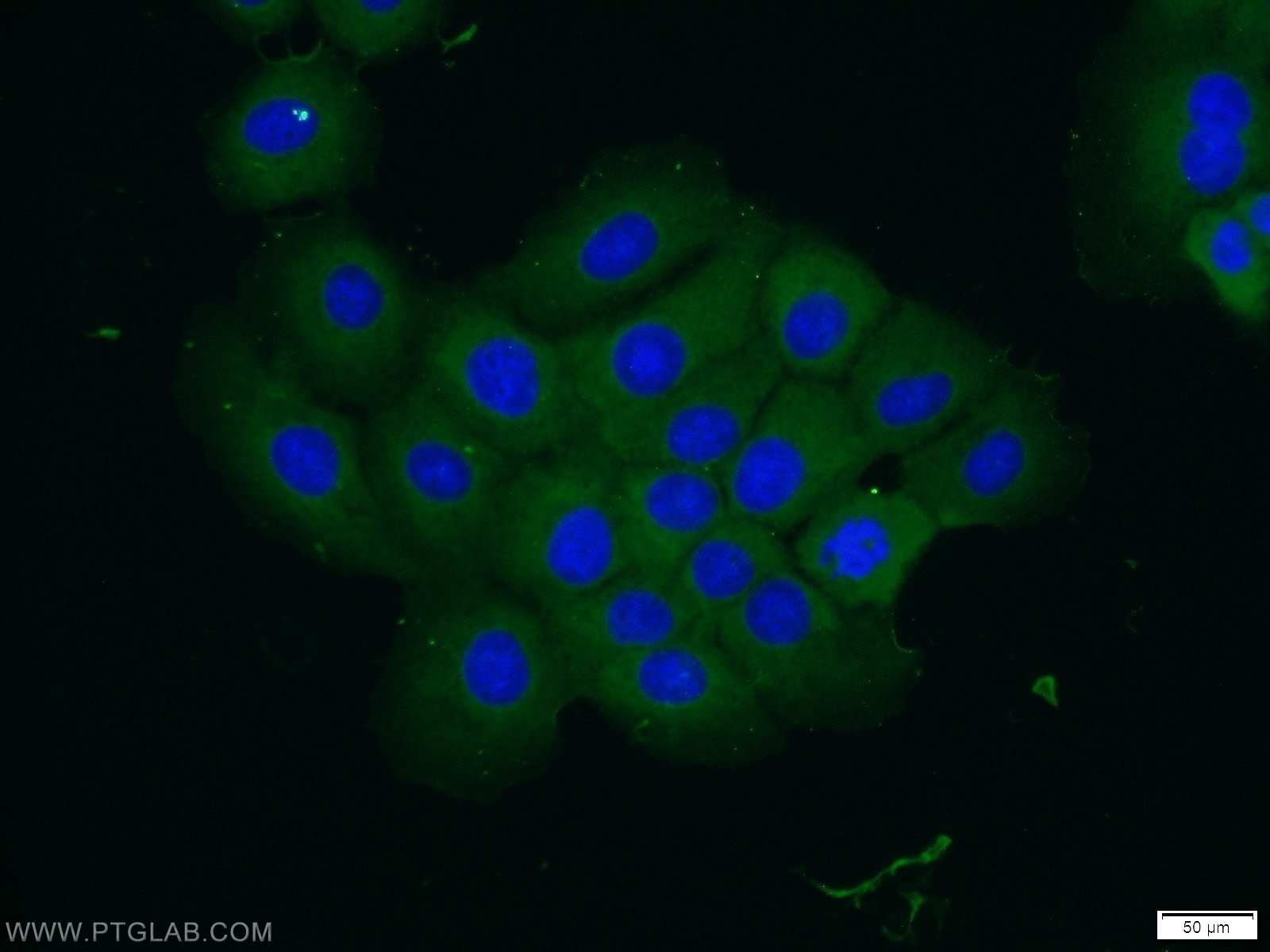 Immunofluorescence (IF) / fluorescent staining of A431 cells using VPS4A/B Polyclonal antibody (17673-1-AP)