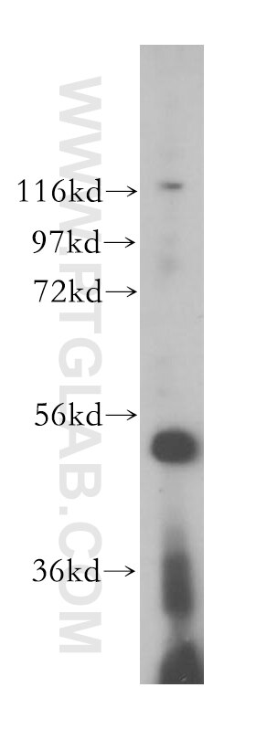 Western Blot (WB) analysis of MCF-7 cells using VPS4A/B Polyclonal antibody (17673-1-AP)