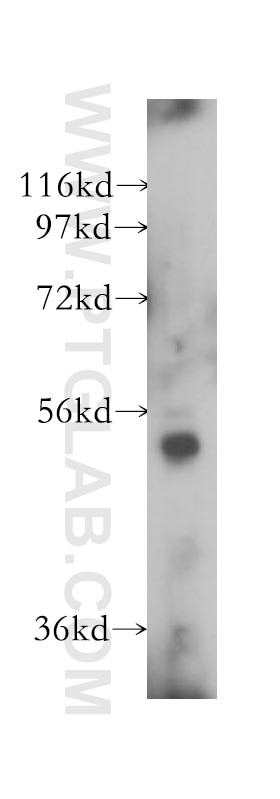 Western Blot (WB) analysis of mouse skin tissue using VPS4A/B Polyclonal antibody (17673-1-AP)