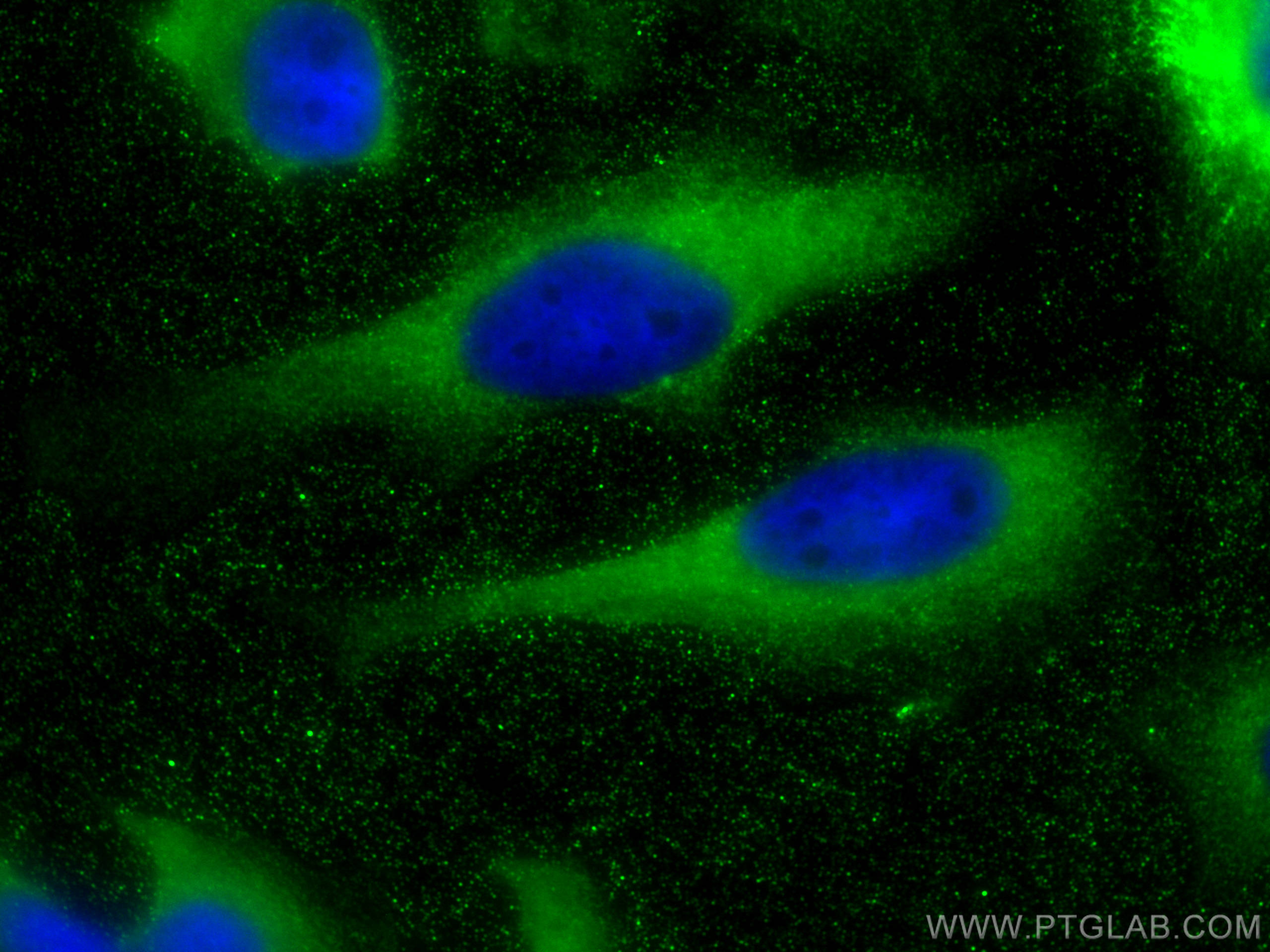 Immunofluorescence (IF) / fluorescent staining of HeLa cells using VPS4B Monoclonal antibody (68443-1-Ig)
