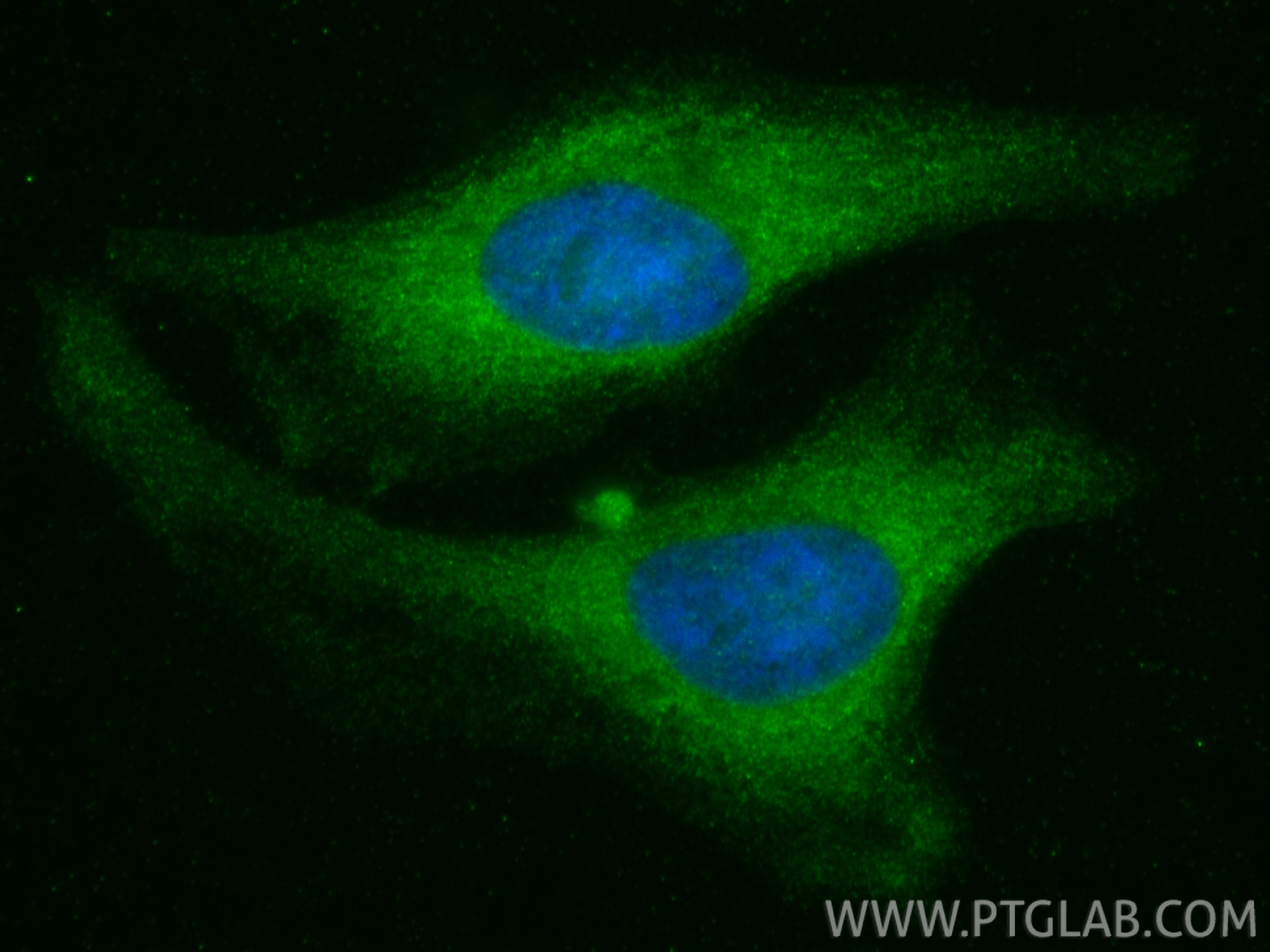 Immunofluorescence (IF) / fluorescent staining of HeLa cells using VPS4B Monoclonal antibody (68443-1-Ig)