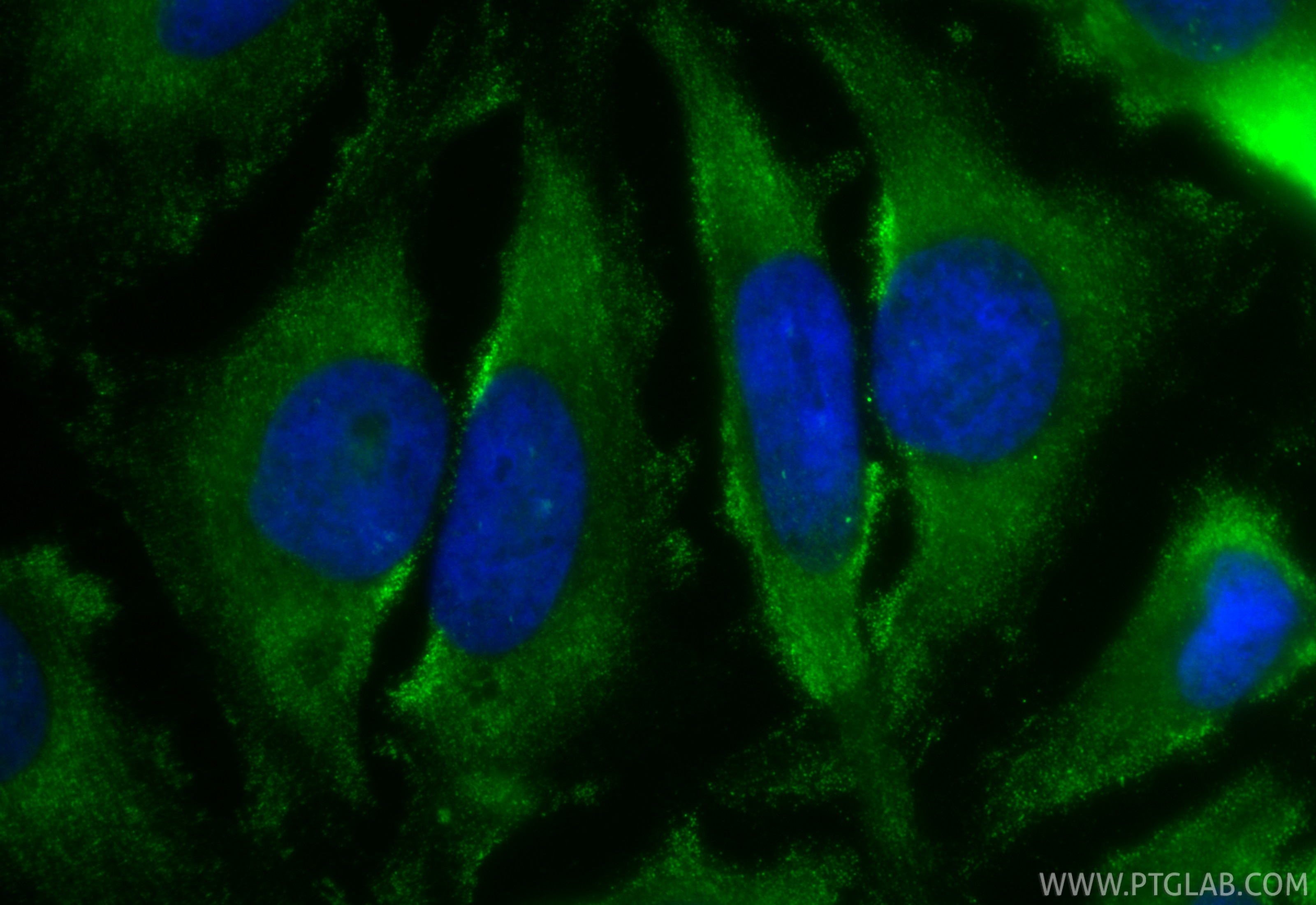 IF Staining of HeLa using CL488-68443 Immunofluorescence (IF) / fluorescent staining of HeLa cells using CoraLite® Plus 488-conjugated VPS4B Monoclonal ant (CL488-68443)
