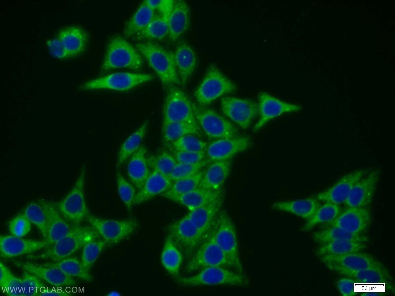 Immunofluorescence (IF) / fluorescent staining of HepG2 cells using VPS52 Polyclonal antibody (11662-2-AP)