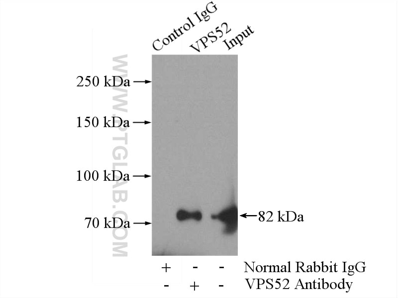 Immunoprecipitation (IP) experiment of mouse skin tissue using VPS52 Polyclonal antibody (11662-2-AP)