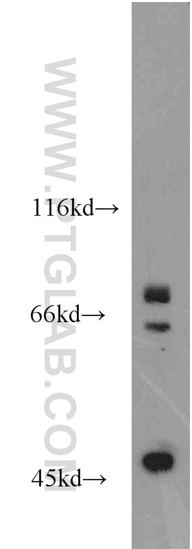 Western Blot (WB) analysis of HepG2 cells using VPS52 Polyclonal antibody (11662-2-AP)
