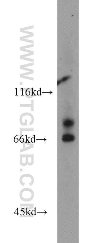 Western Blot (WB) analysis of mouse skin tissue using VPS52 Polyclonal antibody (11662-2-AP)